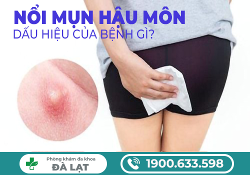 NỔI MẨN ĐỎ HẬU MÔN
